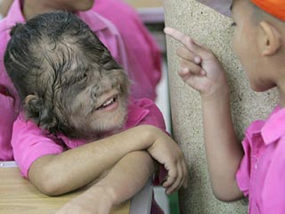 Название: werewolf-syndrome.jpg
Просмотров: 3366

Размер: 15.5 Кб