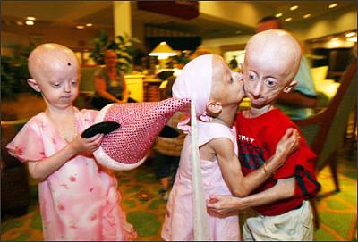 Нажмите на изображение для увеличения
Название: progeria.jpg
Просмотров: 1017
Размер:	43.8 Кб
ID:	5548