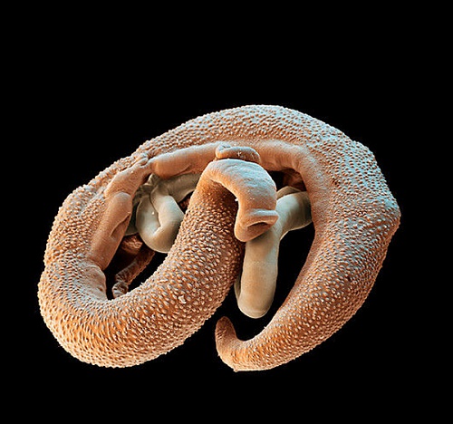 Нажмите на изображение для увеличения
Название: Z1600120-Mating_schistosome_flukes,_SEM-SPL.jpg
Просмотров: 138
Размер:	28.9 Кб
ID:	80648