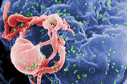 Нажмите на изображение для увеличения
Название: 800px-HIV-budding-Color.jpg
Просмотров: 316
Размер:	119.2 Кб
ID:	82480