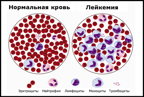 Нажмите на изображение для увеличения
Название: leikoz-2.jpg
Просмотров: 772
Размер:	65.1 Кб
ID:	83335