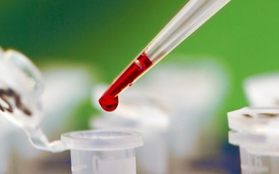Название: unikalnyy-metod-diagnostiki-raka.jpg
Просмотров: 905

Размер: 15.4 Кб